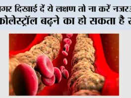 High Cholesterol Signs
