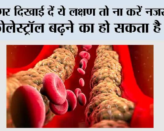 High Cholesterol Signs
