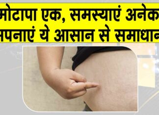 Obesity treatment in Ayurveda