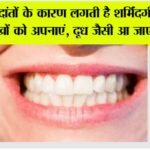 Teeth Whitening Remedies