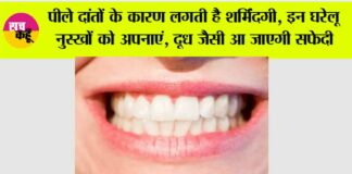 Teeth Whitening Remedies