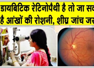 Diabetic Retinopathy