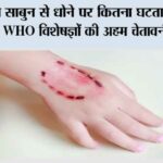 Dog Bite