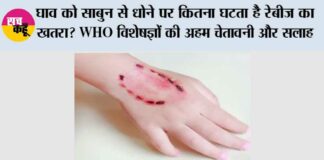 Dog Bite