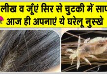 Head Lice Treatment