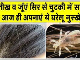 Get rid of lice and dandruff