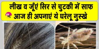 Head Lice Treatment