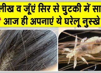 Head Lice Treatment
