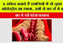High Cholesterol Signs