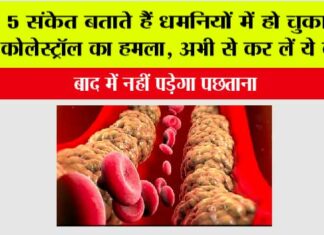 High Cholesterol Signs