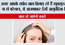 White Hair Home Remedy
