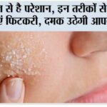 Benefits Of Alum On Skin
