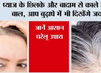 Hair Care Tips: प्याज के छिलके और बादाम से काले होंगे बाल, आप बुढ़ापे में भी दिखेंगे जवां, जानें आसान घरेलू उपाय Hair Care Tips