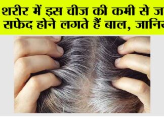 White Hair Problem: “बाल सफेद क्यों होते हैं? जाने क्या है विटामिन B-12 की अहमियत” White Hair Problem