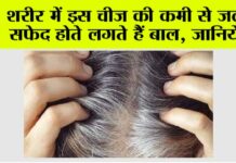 White Hair Problem: “बाल सफेद क्यों होते हैं? जाने क्या है विटामिन B-12 की अहमियत” White Hair Problem