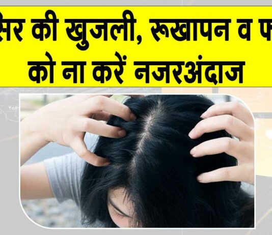 Itchy Scalp Treatment