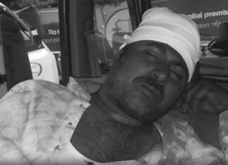 Diamond Harbour attack