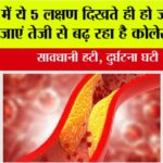 Signs of High Cholesterol