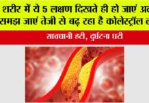 Signs of High Cholesterol