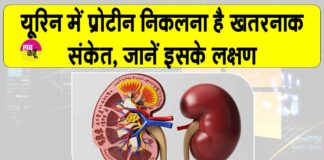 Proteinuria Symptoms