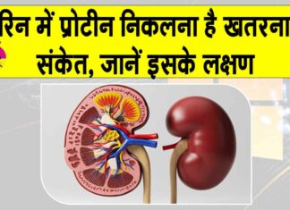 Proteinuria Symptoms: कहीं आपके यूरिन में भी प्रोटीन तो नहीं निकल रहा, जानें कितना है ये खतरनाक? Proteinuria Symptoms