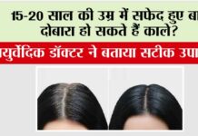 White Hair: 15-20 साल की उम्र में सफेद हुए बाल दोबारा हो सकते हैं काले? आयुर्वेदिक डॉक्टर ने बताया सटीक उपाय White Hair