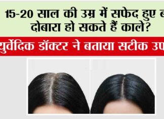 White Hair: 15-20 साल की उम्र में सफेद हुए बाल दोबारा हो सकते हैं काले? आयुर्वेदिक डॉक्टर ने बताया सटीक उपाय White Hair
