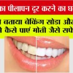 Dant Chamkane Ka Gharelu Upay: दांतों का पीलापन दूर करने का घरेलू नुस्खा: डॉक्टर ने बताया बेकिंग सोडा और नारियल तेल से कैसे पाएं मोती जैसे सफेद दांत Dant Chamkane Ka Gharelu Upay