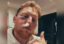 Ben Stokes: इंग्लैंड के टेस्ट कप्तान बेन स्टोक्स का बिगड़ा चेहरा! लिया ये बड़ा फैसला! Ben Stokes News