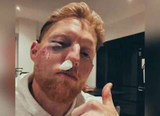 Ben Stokes: इंग्लैंड के टेस्ट कप्तान बेन स्टोक्स का बिगड़ा चेहरा! लिया ये बड़ा फैसला! Ben Stokes News